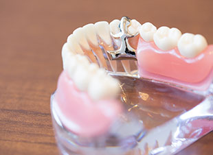 説明用の歯の模型
